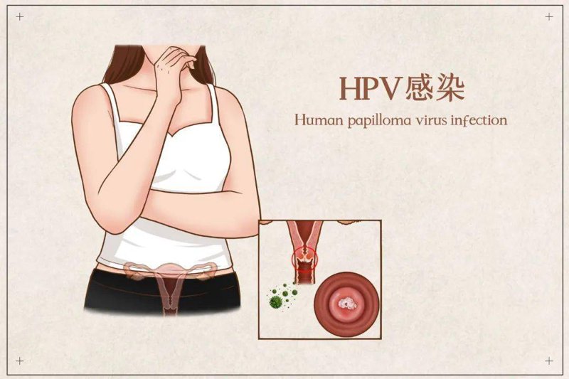 妇科炎症会引起腰疼吗？对比解析让你一目了然