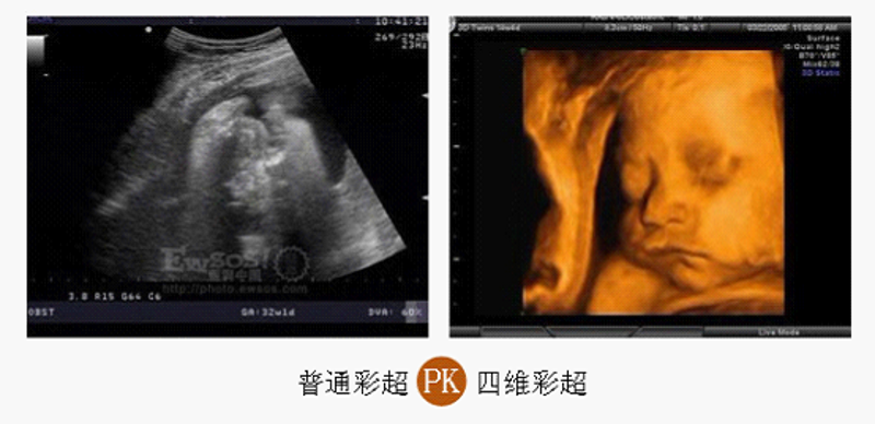 妇科检查前“禁房事”：数据告诉你最准确的等待时间——宁波鄞州同仁医院案例对比解读