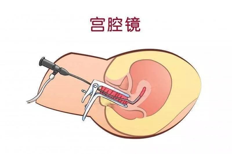 计划生育批准全攻略：从申请到拿证一步到位